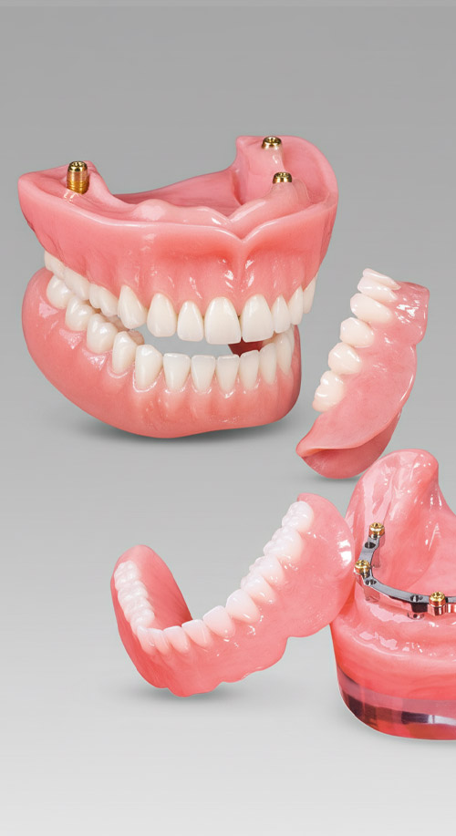 Overdenture at Dental Vana