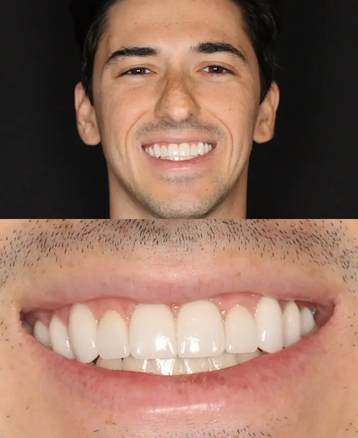 After Image
