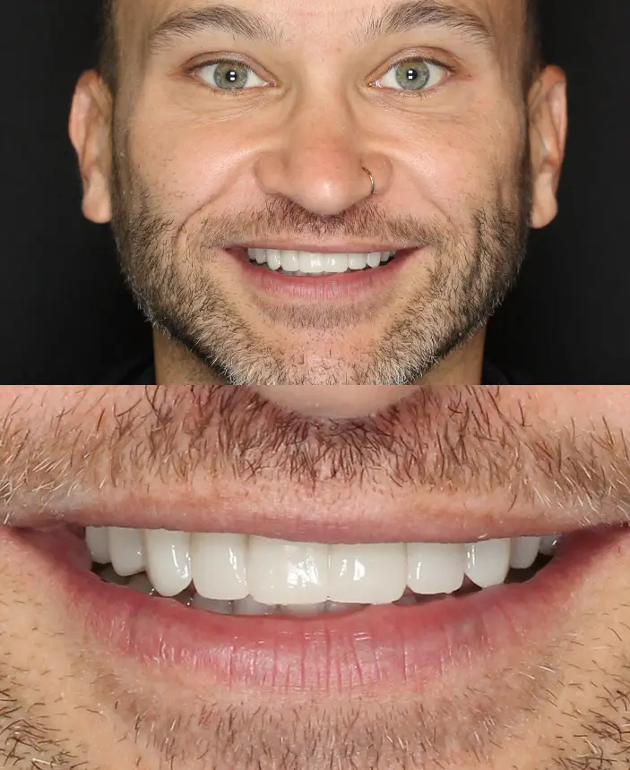 After Image
