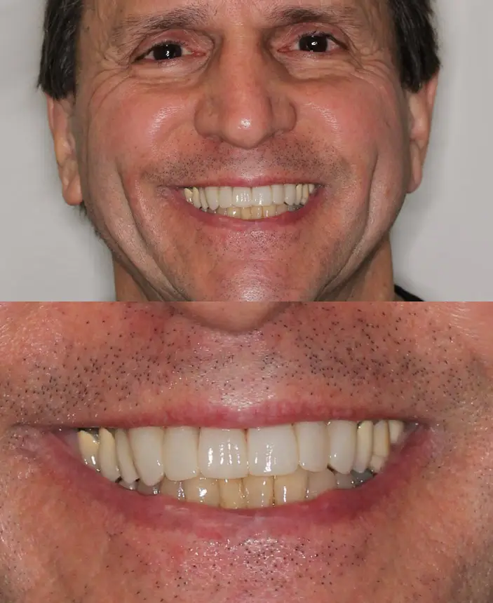 After Image