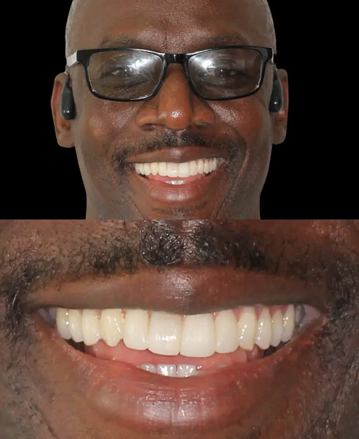 After Image