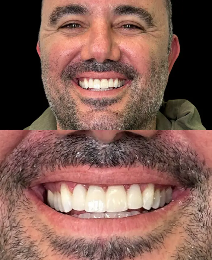 After Image