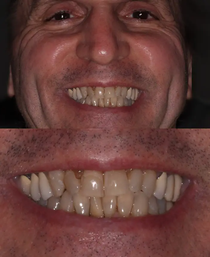 Before Image